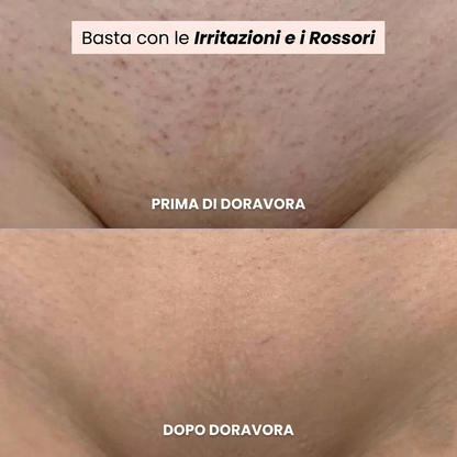 Rasoio Doravora® 2 in 1